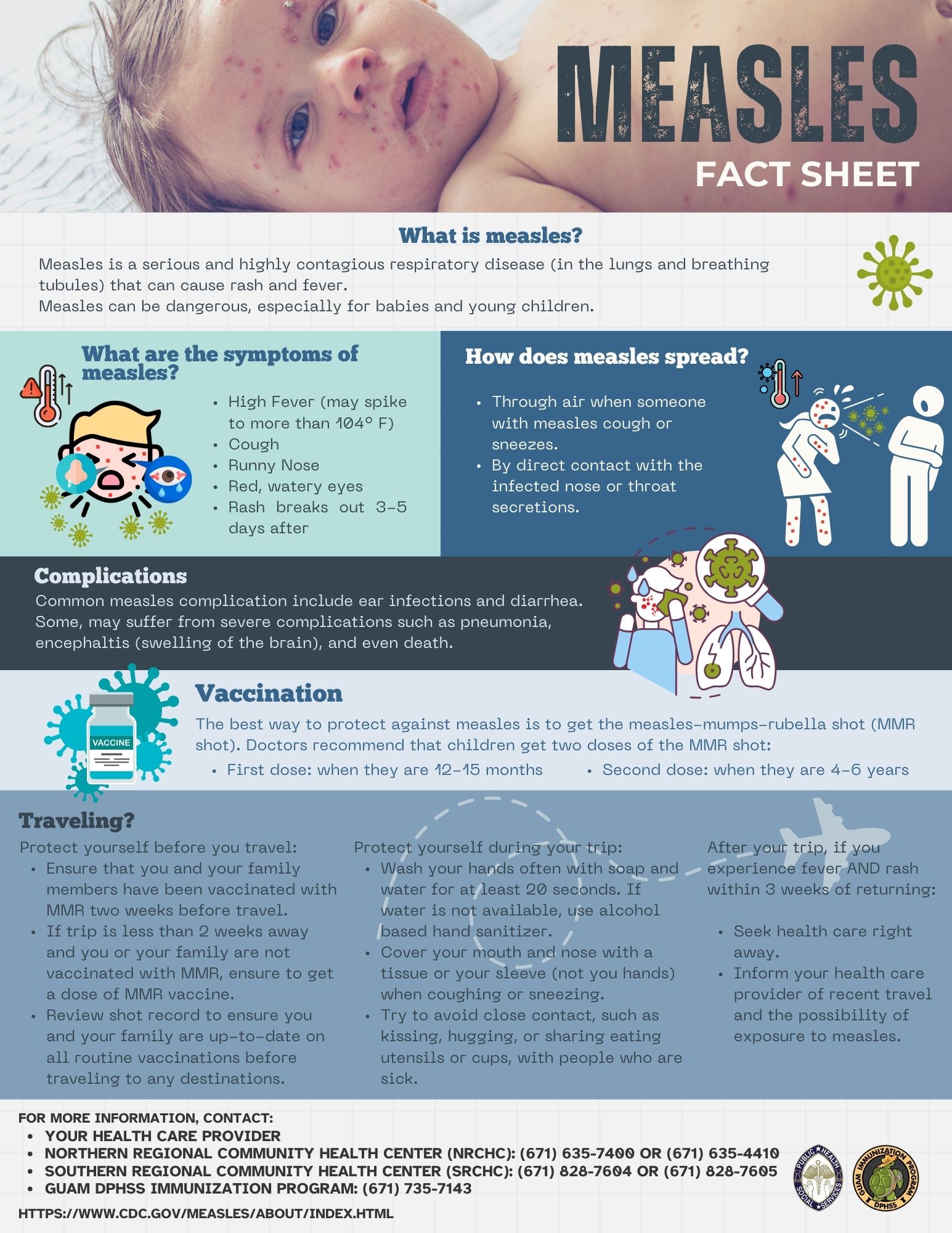 Measles Fact Sheet